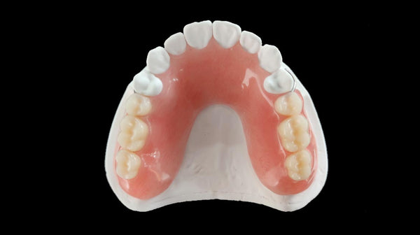 Immediate Partial Denture